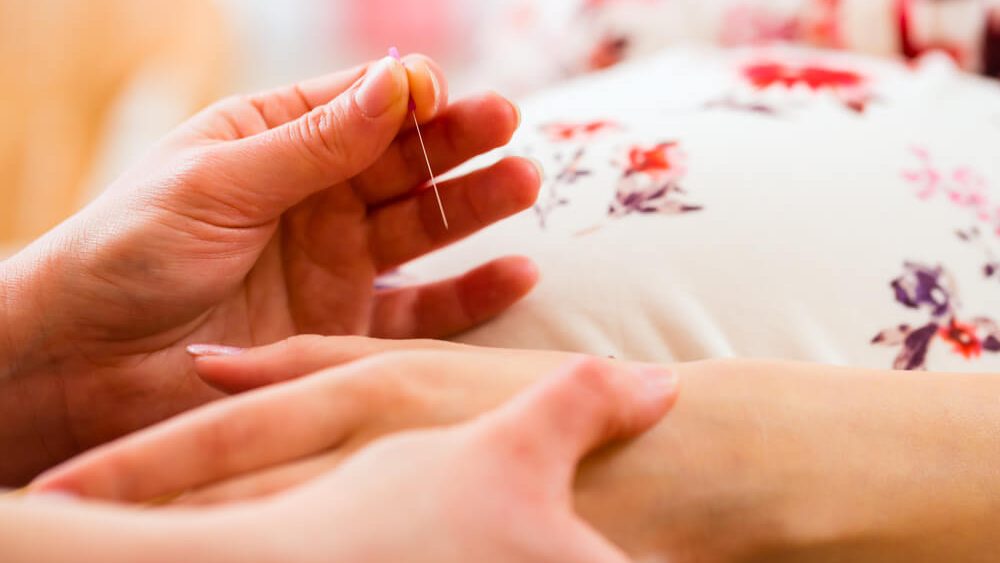 Pregnancy Acupuncture Brisbane Northside | Is It Safe?